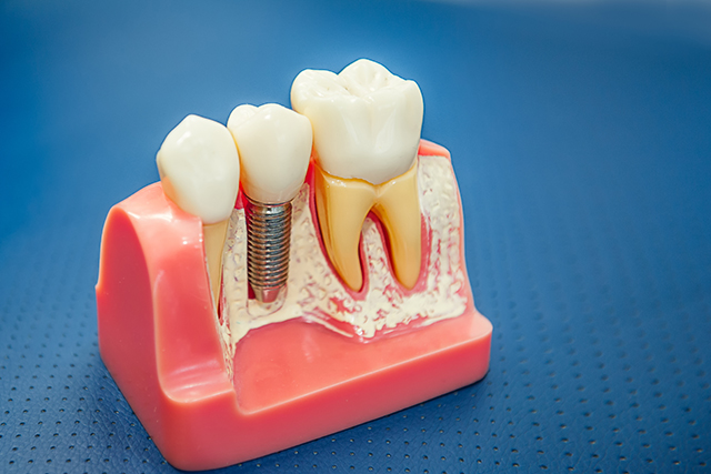 periodontal plastic surgery