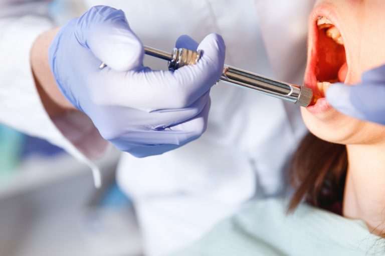 All About Wisdom Teeth Anesthesia