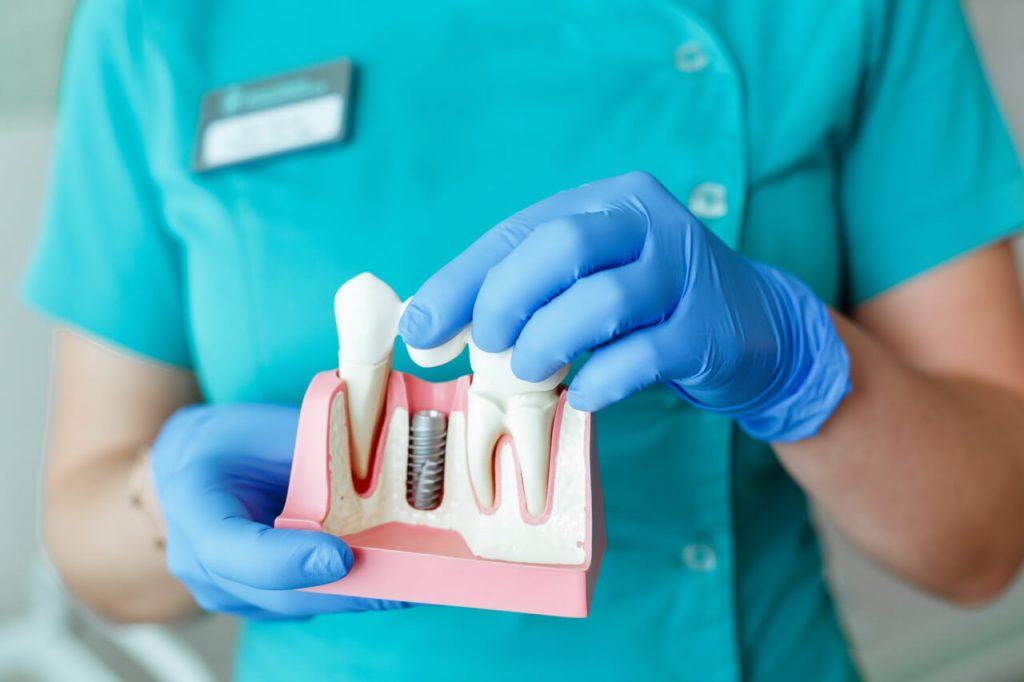 tooth extraction and implant timeline