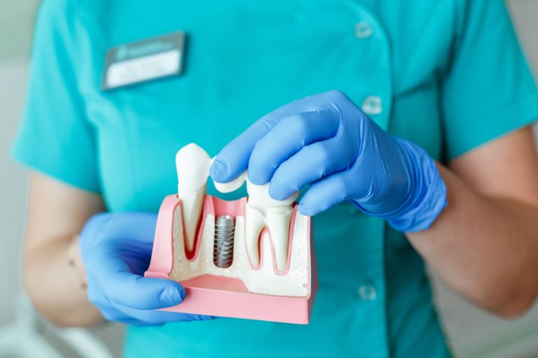 A comprehensive tooth extraction and implant timeline