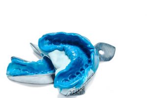 teeth molds for braces