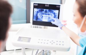 Information about dental x-ray equipment