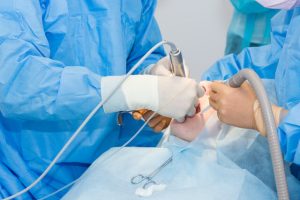 dental implant failure refund
