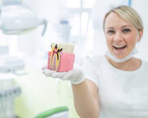 Dental Mild Procedure 3 Dental Examples