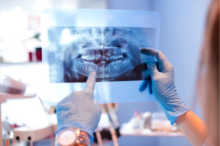 What Is An Oral And Maxillofacial Surgeon? What Do They Do?