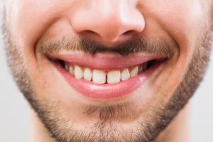why do we have wisdom teeth