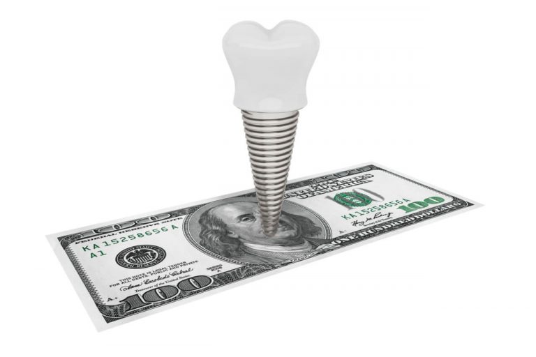 Implant Dentistry: Cost and After-Procedure Management