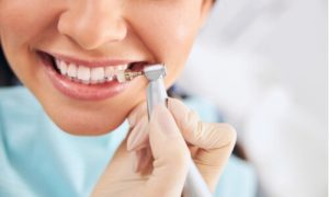 how silver tooth implant works