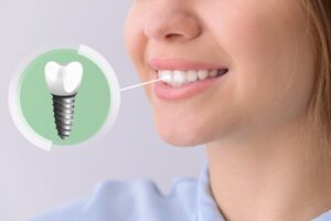 metal tooth implant benefits